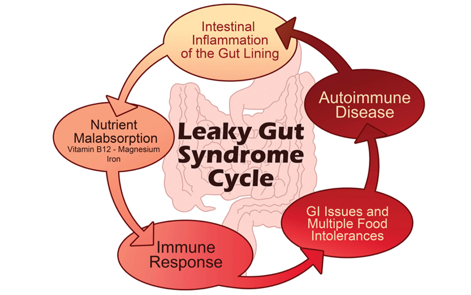 Brain gut diagram