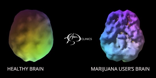 Marijuana Brain